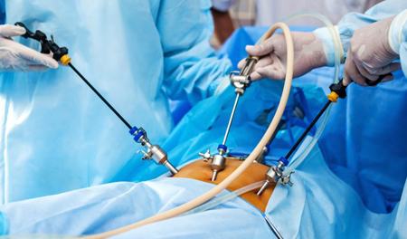 Laparoscopy Surgery (Basic & Advanced Procedures)